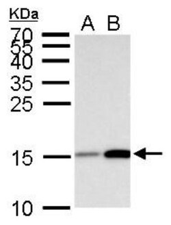 HIST1H3A, ac Lys18 Antibody, Novus Biologicals 0.1mL:Antibodies, Polyclonal